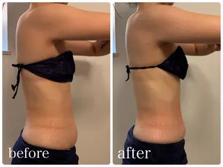 23beauty所属・武藤 那月のエステ・リラクイメージ