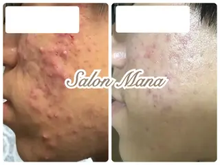 Salon Mana✨三貴のマツエク・マツパデザイン