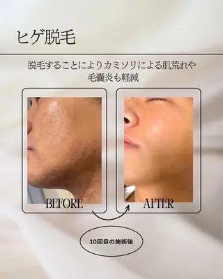 メンズ 六本木/似合わせ眉毛 andＳ🍀Yuriのエステ・リラクイメージ