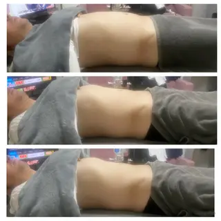 セルライトクラッシュ ＆腸もみ＋骨盤矯正のその他イメージ