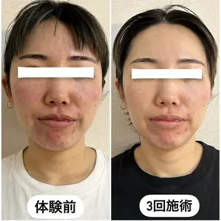 肌管理 OGUMOのエステ・リラクイメージ