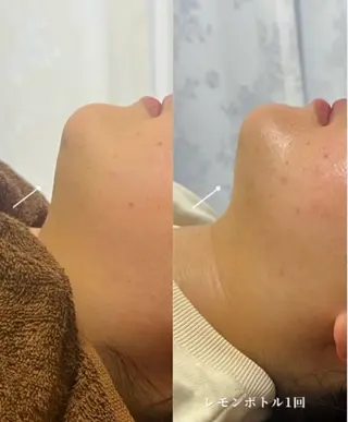 ナスサロasuka. 🕯️🤎のエステ・リラクイメージ