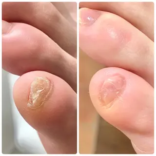 ネイル ⭐️遠藤 夏純⭐️のエステ・リラクイメージ