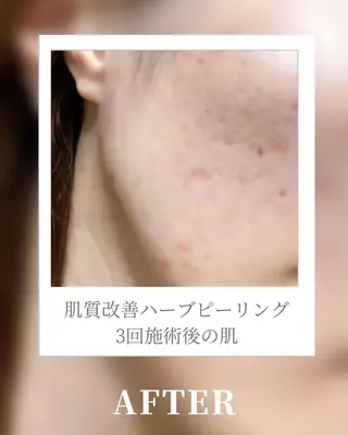 🎀BiBi韓国美容 コスパ強！美活サロンのエステ・リラクイメージ