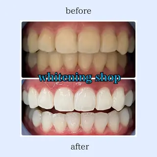 ホワイトニング ショップ伊丹店のその他イメージ