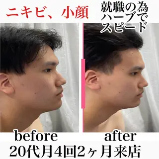 小顔・ニキビ ・脱毛サロンのエステ・リラクイメージ