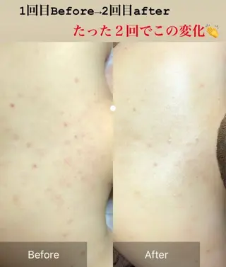 齋藤 祐里耶のエステ・リラクイメージ