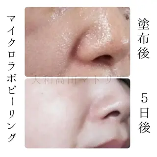 小顔 美肌専門 Matoriaのエステ・リラクイメージ