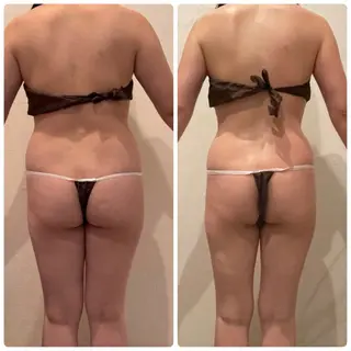 Re:Oasis所属・🦋痩身専門サロン Re:oasis🦋のエステ・リラクイメージ