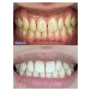 Ｍ渋谷 ホワイトニングのエステ・リラクイメージ