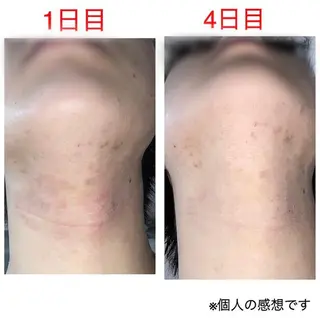 tominaga ryokoのヘアスタイル