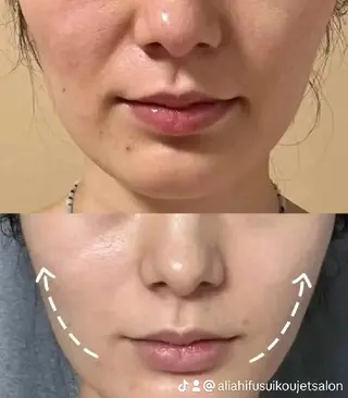 マツエク・マツパ aliaハイフ&水光ジェットサロン所属・aliaハーブ水光店 エステティシャン募集のエステ・リラクイメージ