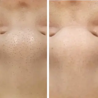 シミケア専門サロンLICCO’S所属・シミケア専門サロン LICCO’S岡崎のエステ・リラクイメージ