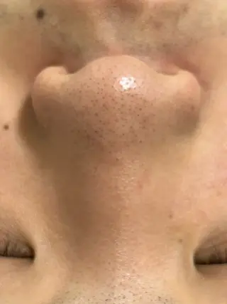 麻布十番エステサロン WhiteAzabuのエステ・リラクイメージ