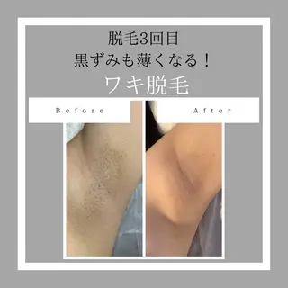 脱毛サロン Lokahiのエステ・リラクイメージ