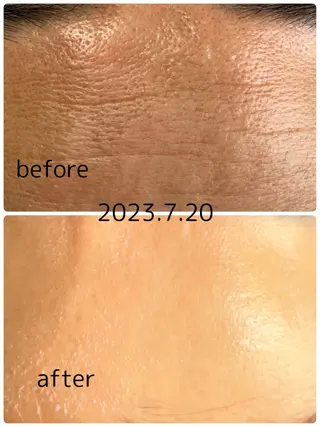 YURUMARU 河ノ瀬店のエステ・リラクイメージ