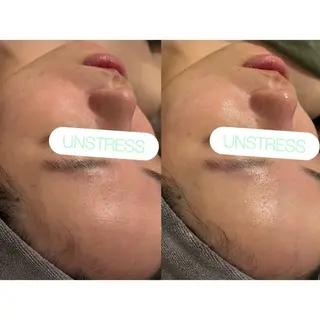 小顔コルギ ☆表参道/外苑前のエステ・リラクイメージ