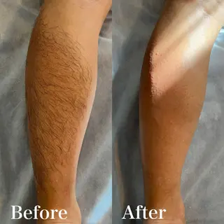 メンズ wax脱毛専門店 ハイラントのエステ・リラクイメージ