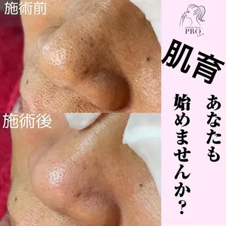 Mignon + Natsukiのマツエク・マツパデザイン