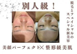 🎀美肌ケアサロン 🎀レイビス銀座店のエステ・リラクイメージ