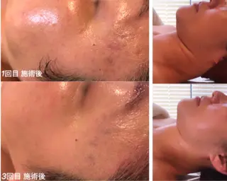 エステティックルーム Beauce.のエステ・リラクイメージ