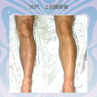 💠the4💠【脱毛特化サロン】所属・LED脱毛サロン 💐ayaのエステ・リラクイメージ