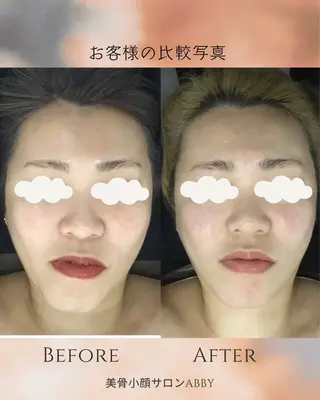 小顔コルギ💎 ABBY SANOのエステ・リラクイメージ