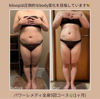 《本気痩せ×疲労改善 》  BILOOPのエステ・リラクイメージ