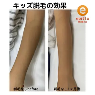 キッズ エピット横浜磯子店 大森のエステ・リラクイメージ