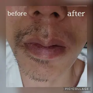 メンズ Lutella所属・ワックス脱毛専門店 Lutellaのエステ・リラクイメージ