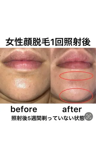 小野 優海のネイルデザイン