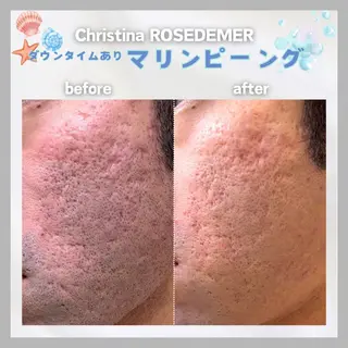 メンズ 肌質改善サロン Meilily🦋のエステ・リラクイメージ