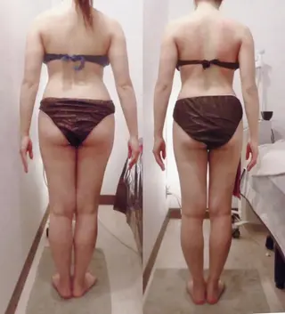 痩身・小顔・脱毛 グレイスボディのエステ・リラクイメージ