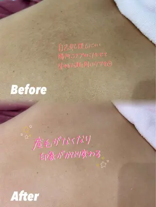 🫧美しい素肌へ🫧 今成柚乃のその他イメージ