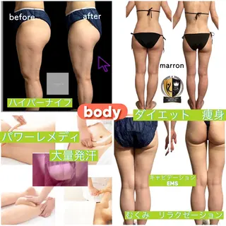 marron所属・痩身ハイパーナイフ ララピールリアボーテのエステ・リラクイメージ