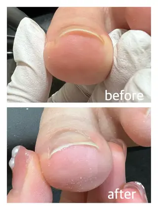 ネイル 巻き爪補正店 堺東店のネイルデザイン