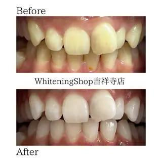 ホワイトニングショッ 吉祥寺2号店のその他イメージ