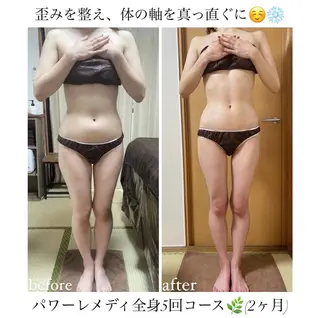 《本気痩せ×疲労改善 》  BILOOPのエステ・リラクイメージ