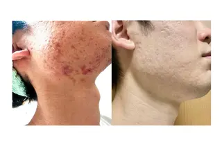 Belchic ベルシックのエステ・リラクイメージ