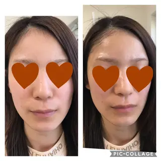 トータルエステサロン Tiaraのエステ・リラクイメージ