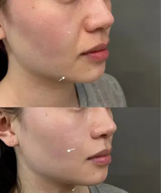 愛維美水光美肌専門店所属・愛維美水光美肌専門店 メンズレディースokのエステ・リラクイメージ