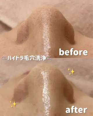 lulularico Yuのエステ・リラクイメージ