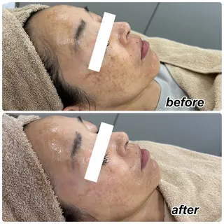 エステサロン Venusのその他イメージ