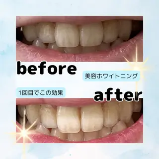 ホワイトニングサロン Soleilのその他イメージ