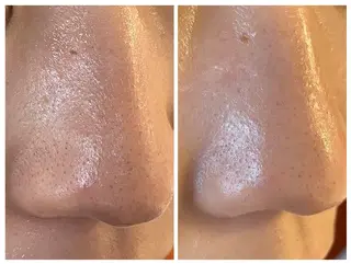 梅本 麿帆のエステ・リラクイメージ