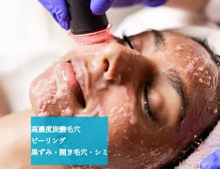 小顔×肌質改善 《お顔の印象》のエステ・リラクイメージ