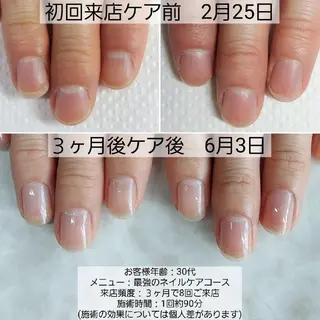 ネイル 栗東駅 徒歩10分 ネイルサロン ディアのネイルデザイン