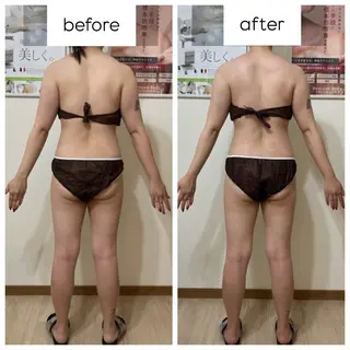 未病ケアサロン　EMINY所属・未病ケアサロン EMINY☺︎勝俣のエステ・リラクイメージ