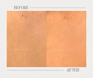 艶肌ワックス ALLY.のエステ・リラクイメージ