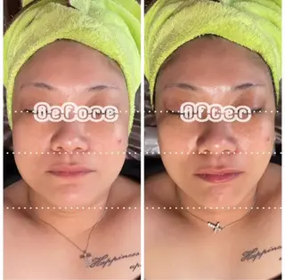 あだち整体エステ 首肩背中のゆるめぐのエステ・リラクイメージ